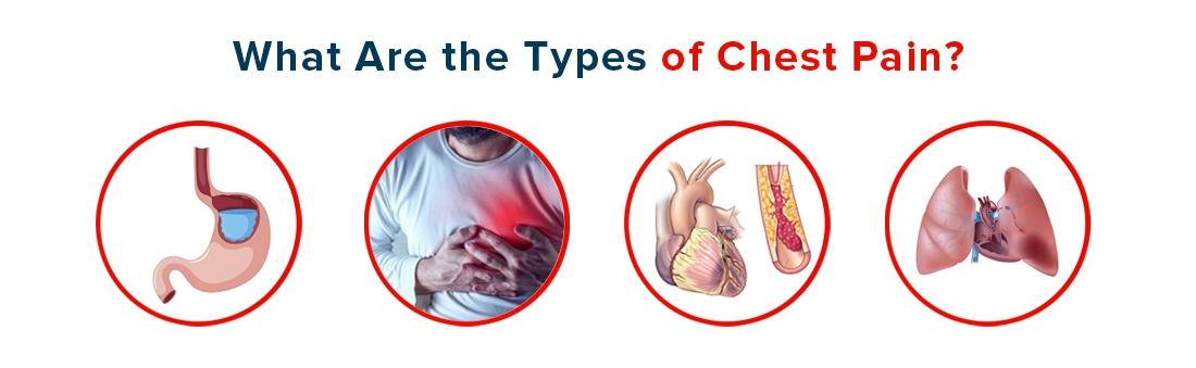 What Are the Types of Chest Pain
